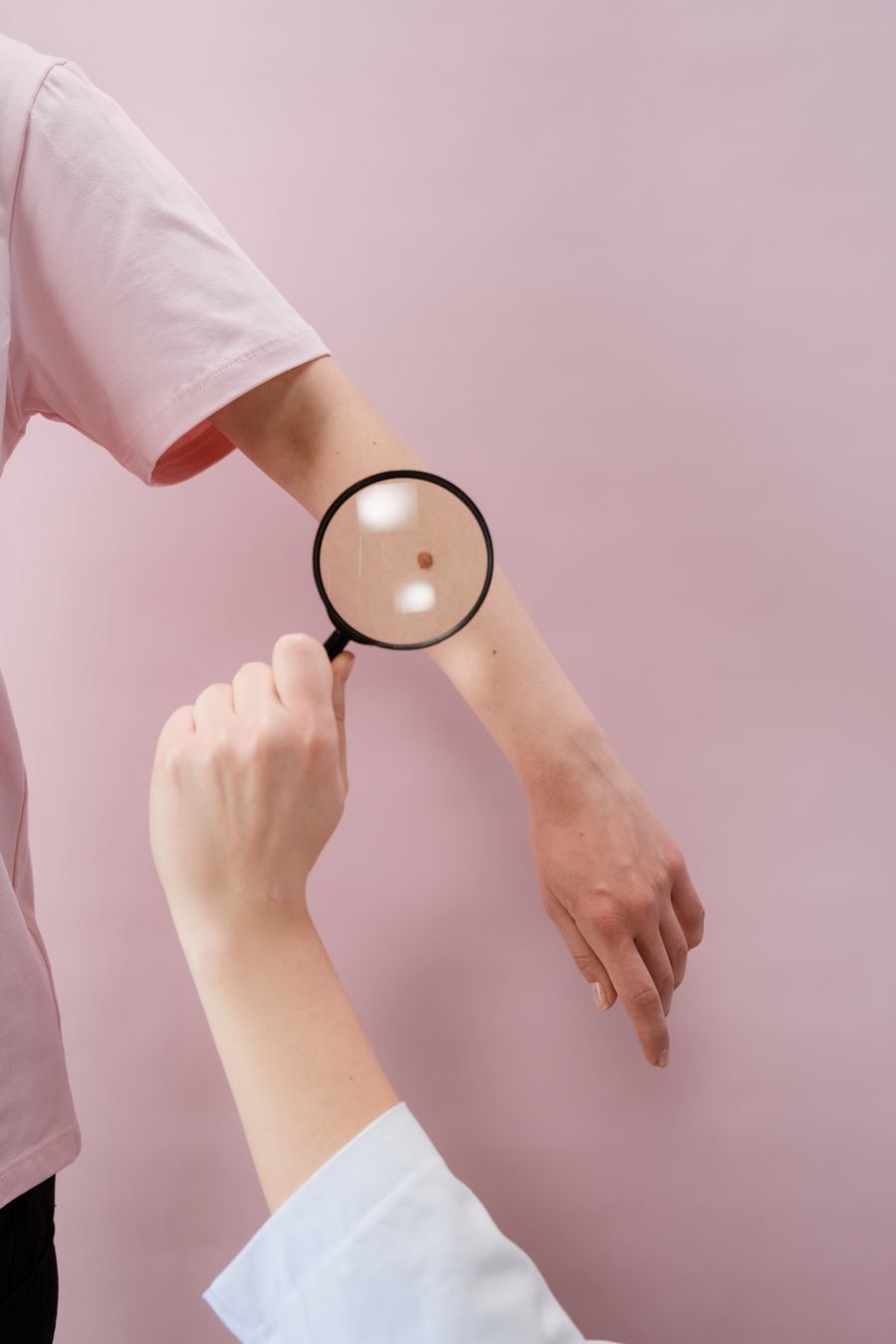 A clinician examining a mole on a patient's arm with a magnifier
